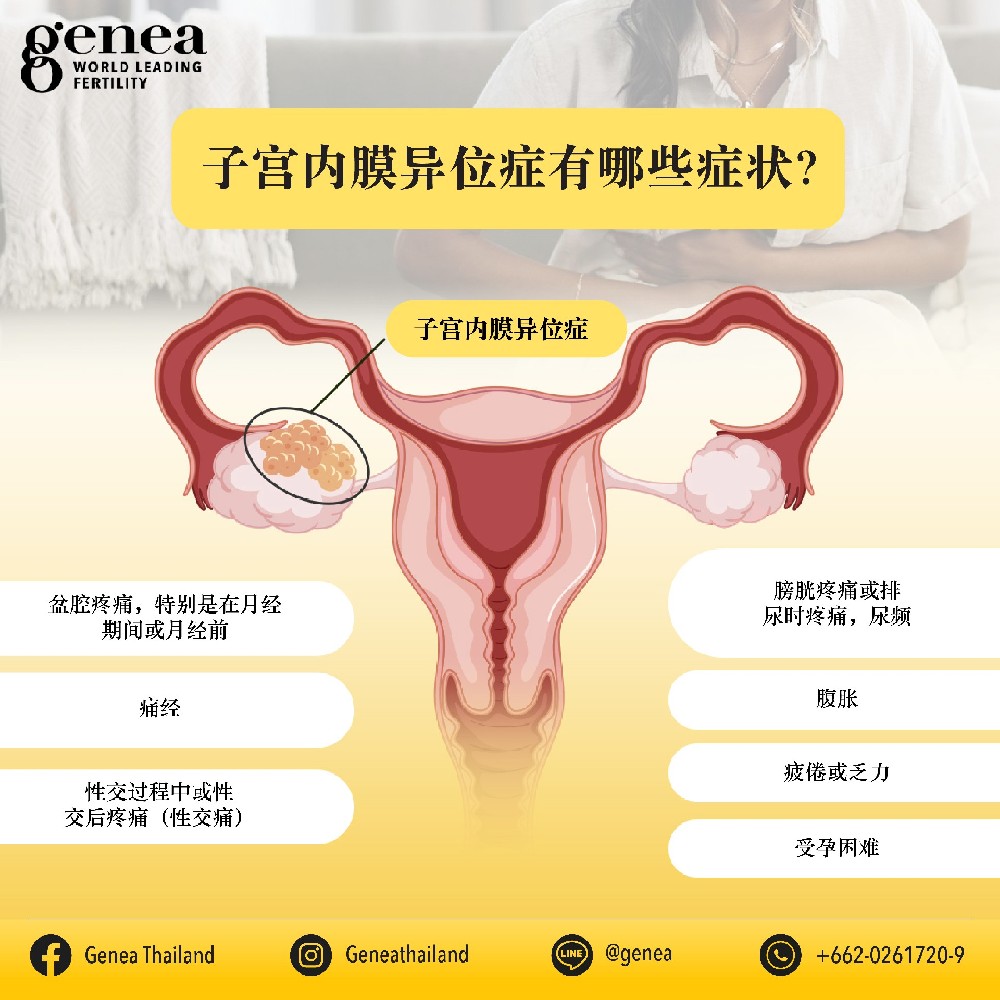Endometriosis-01-CN.jpg